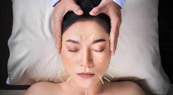 banner of Acupuncture Users Swear By The Relief They Receive