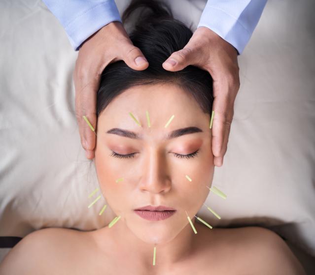 square of Acupuncture Users Swear By The Relief They Receive